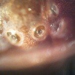 Brachypelma emilia глазки под микроскопом